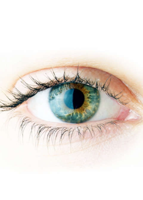 tutorial-image